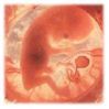 foetus.jpg (2849 bytes)
